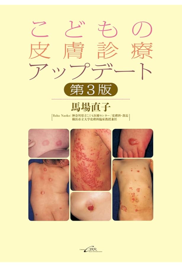 ●裁断済 子どもの皮膚疾患アトラス : 正常?病的?この症状は大丈夫? Amazon.co.jp: 子どもの皮膚疾患アトラス: 正常?病的?この症状は大丈夫